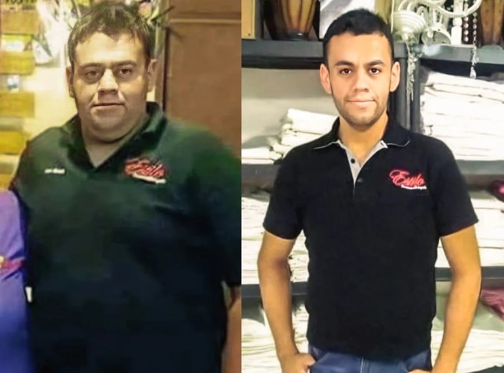 Frontal photograph of a man before and after bariatric surgery. The "before" image shows the man overweight. The "after" image shows significant weight loss, with a leaner figure and a more defined physique. The result reflects the success of the Gastric Sleeve procedure in Tijuana.