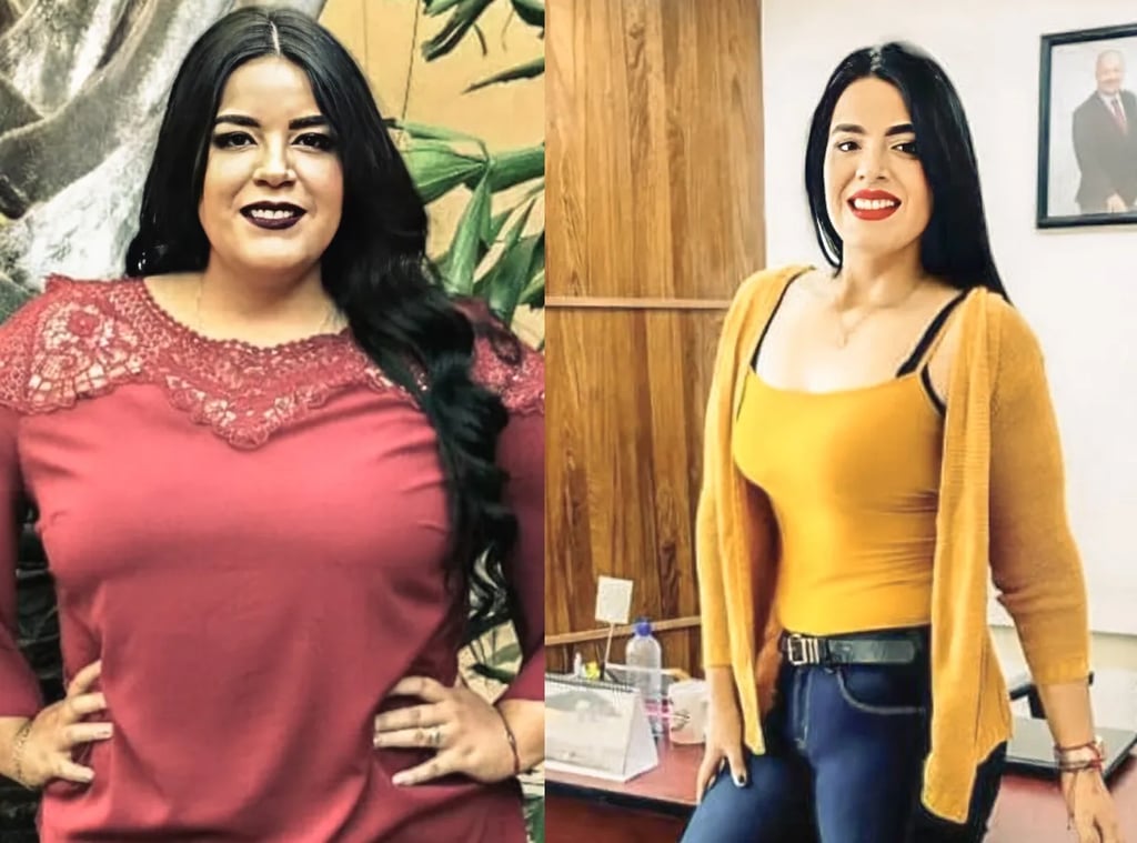 Frontal photograph of a woman before and after bariatric surgery. The "before" image shows the woman overweight. The "after" image shows significant weight loss, with a leaner figure and a more defined physique. The result reflects the success of the Gastric Sleeve procedure in Tijuana.