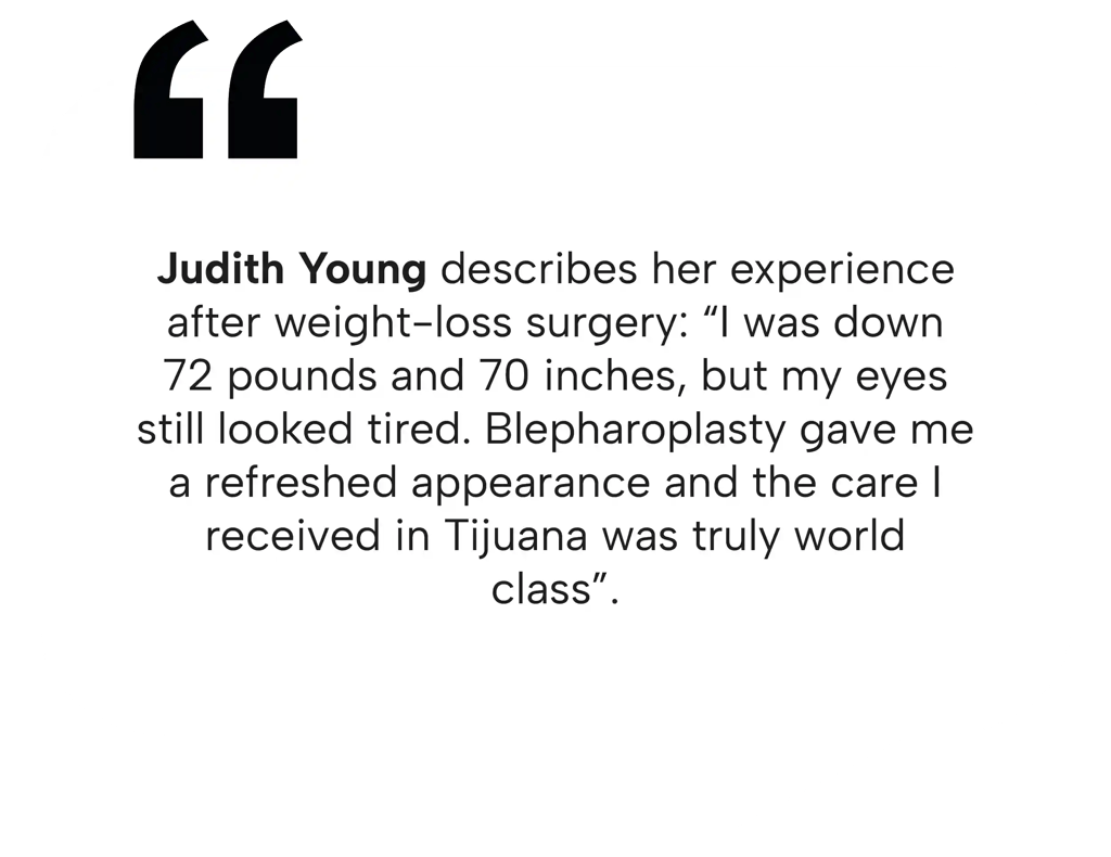 Judith Young testimonial on how eyelid surgery in Tijuana gave her a refreshed appearance after major weight loss.