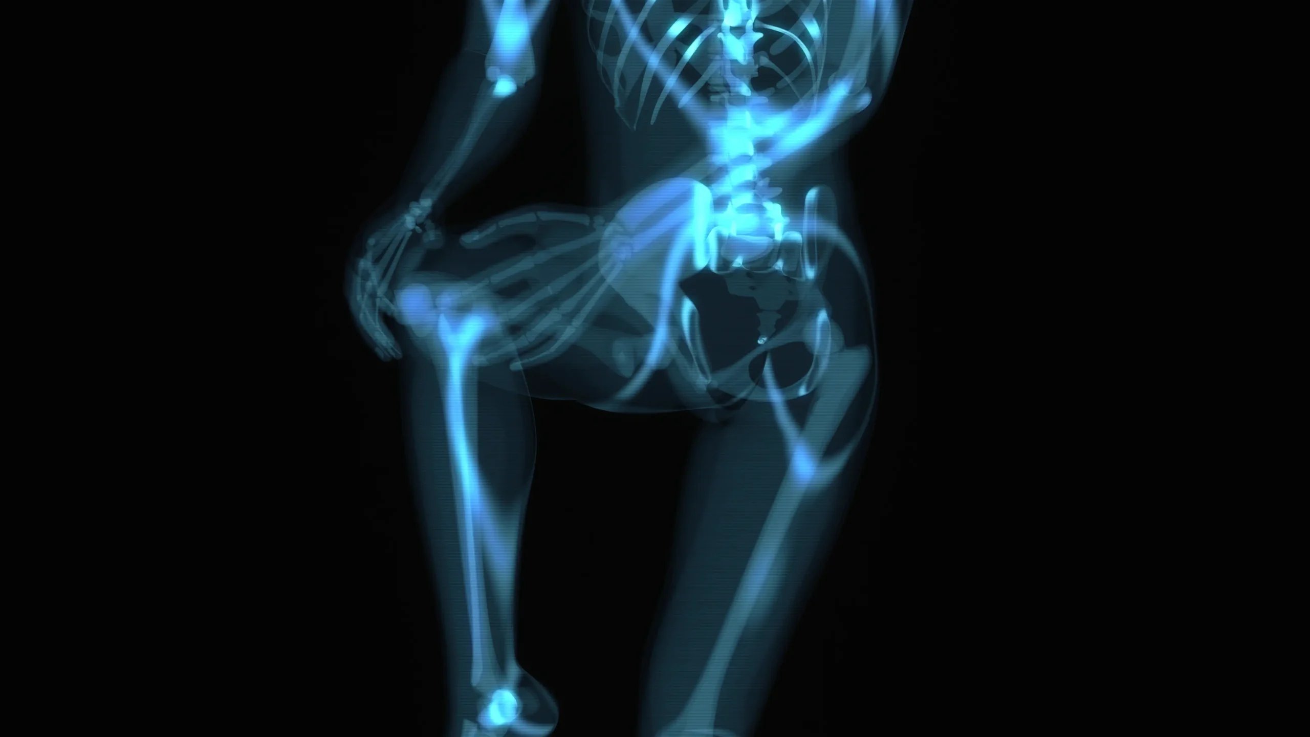 ACL Reconstruction in Tijuana, Mexico 13 3D anatomical model of a knee joint highlighting the area for ACL Reconstruction in Tijuana.