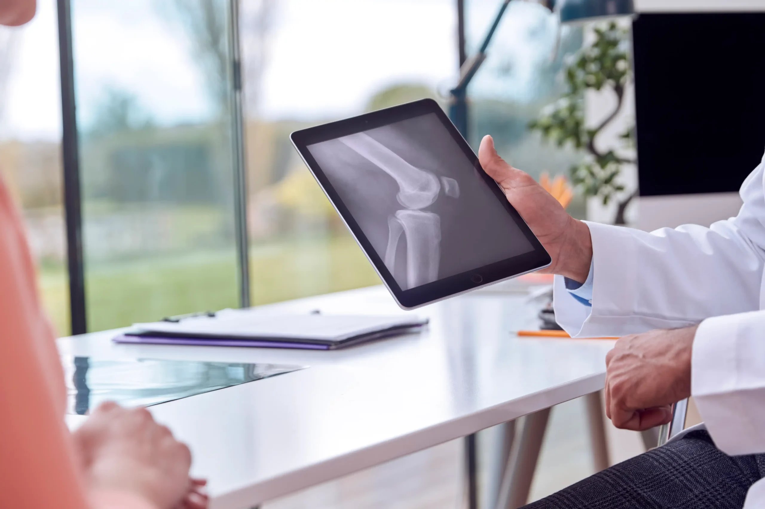 Hip Replacement in Tijuana, Mexico 21 Close-up of a doctor showing a digital X-ray on a tablet to a patient during a hip replacement in Tijuana consultation.