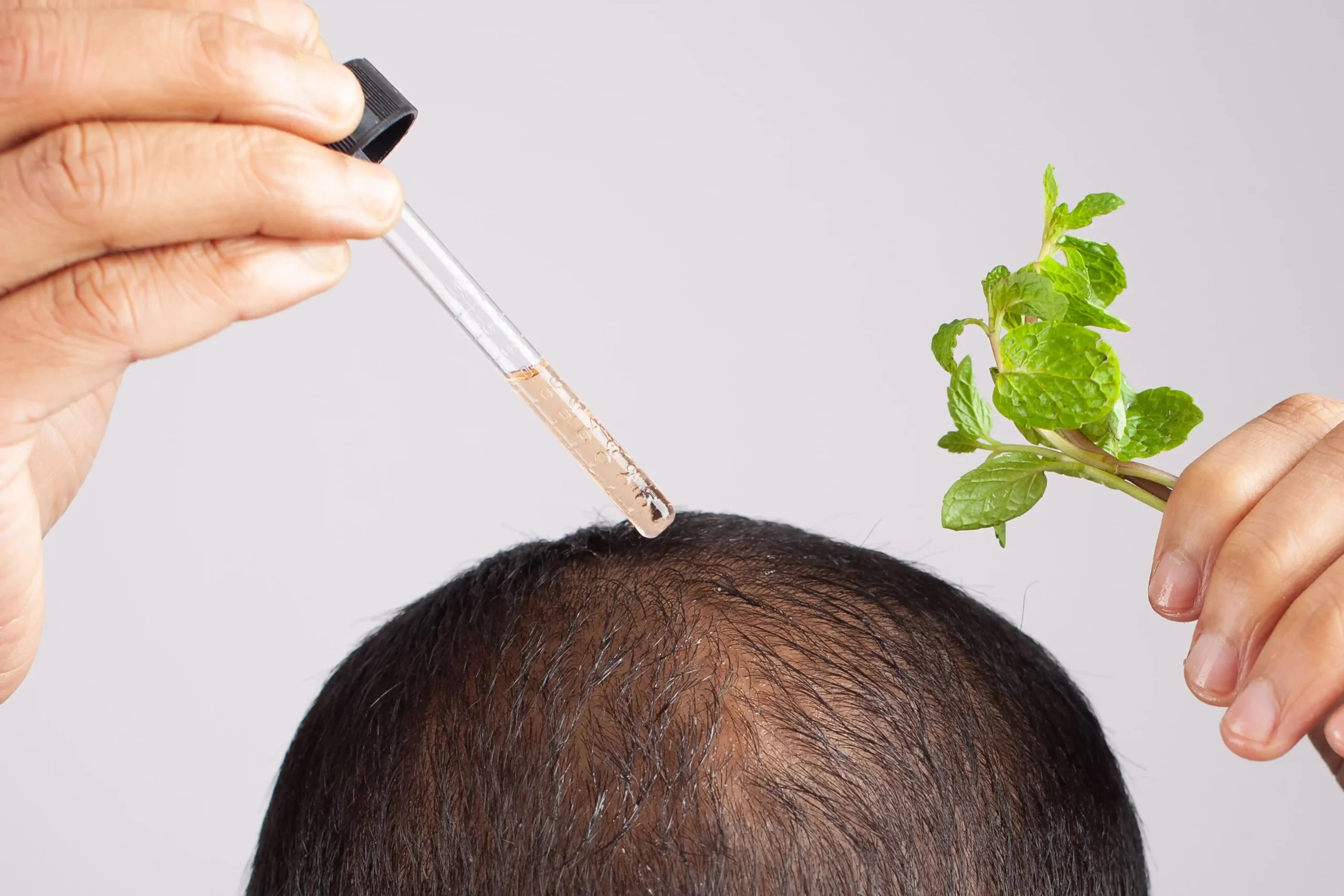Hair Regrowth in Tijuana, Mexico 12 Man applying natural peppermint oil for hair regrowth in Tijuana as a preventive treatment for thinning hair.