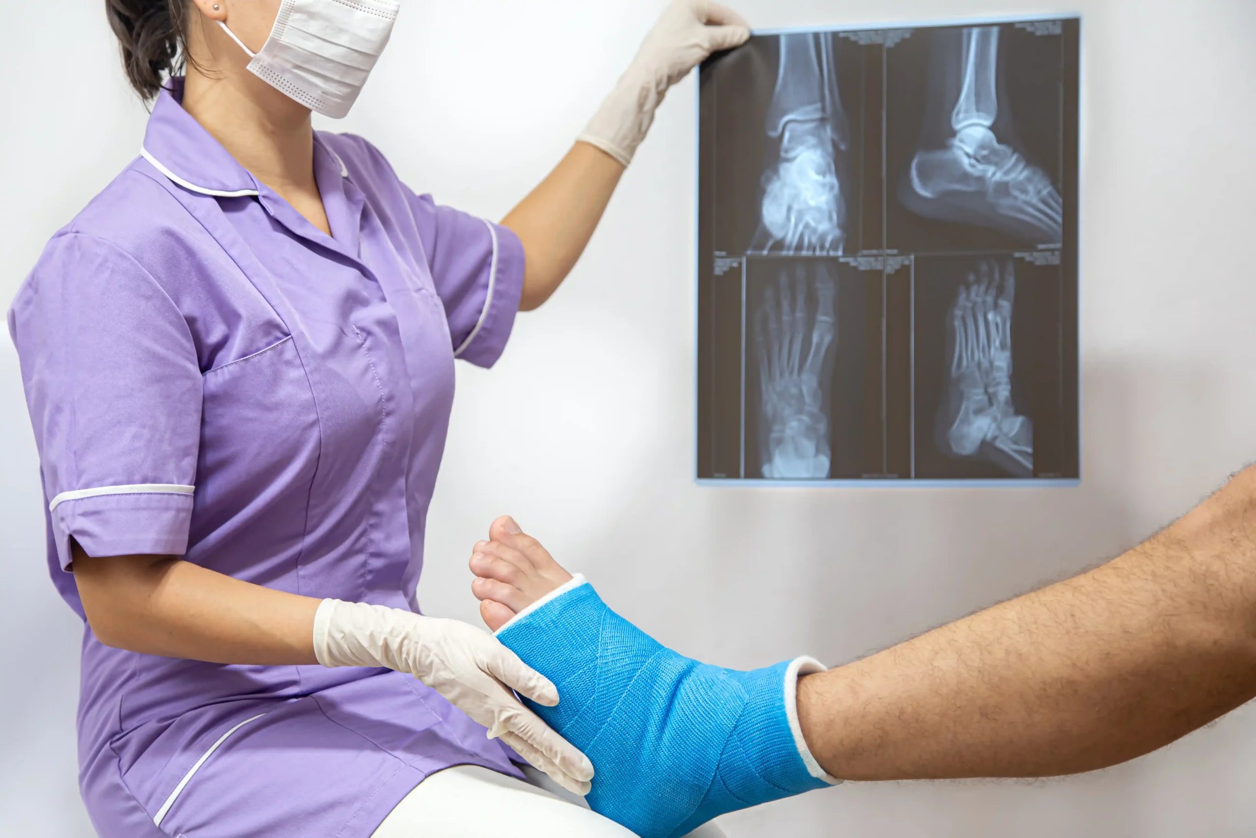 Orthopedic Surgery in Tijuana, Mexico 18 Female medical professional examining a foot x-ray and a patient's casted leg at a safe orthopedic surgery center in Tijuana.