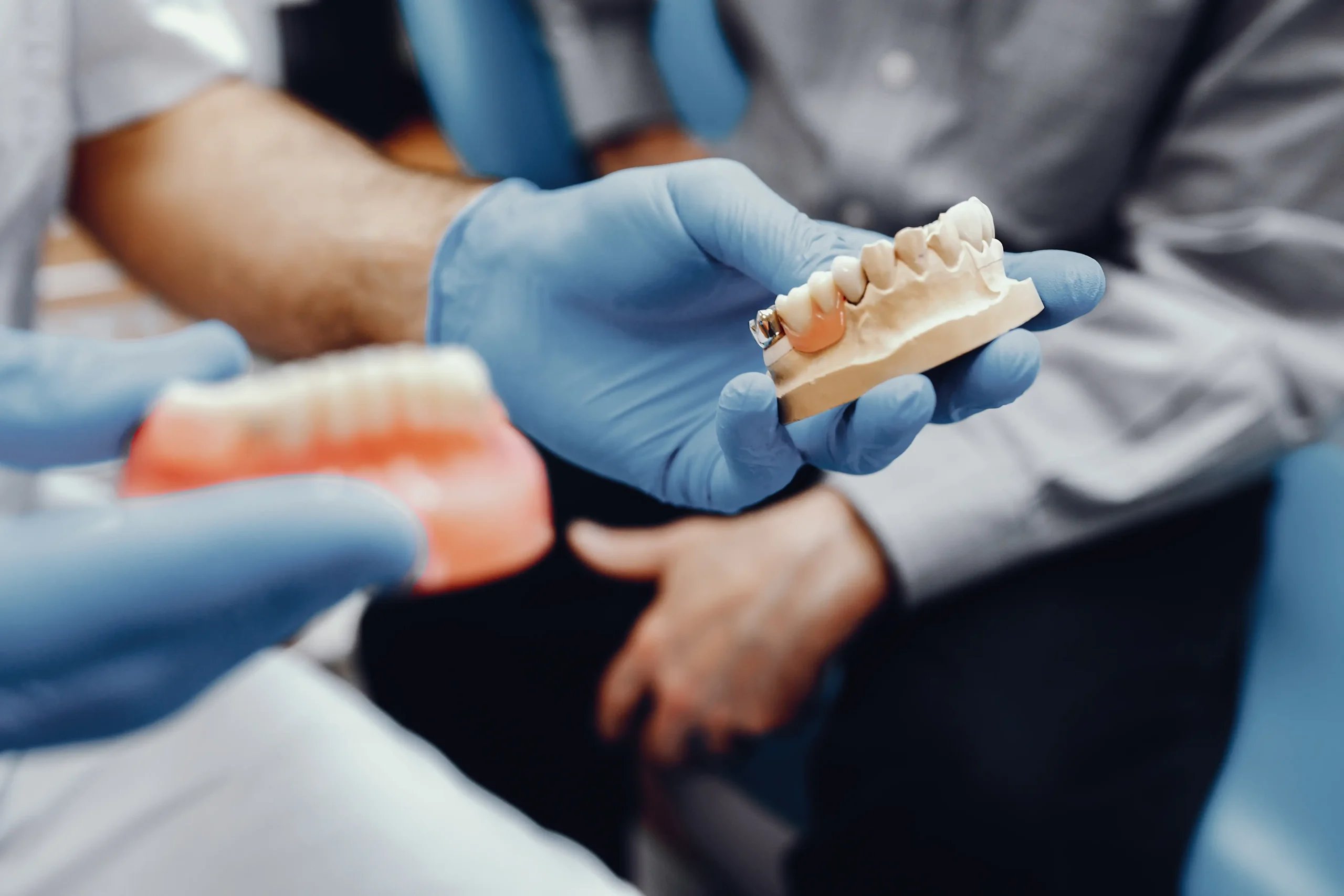 Dentures in Tijuana, Mexico 16 A dentist showing a patient different types of dentures in Tijuana, including partial dentures and full sets.