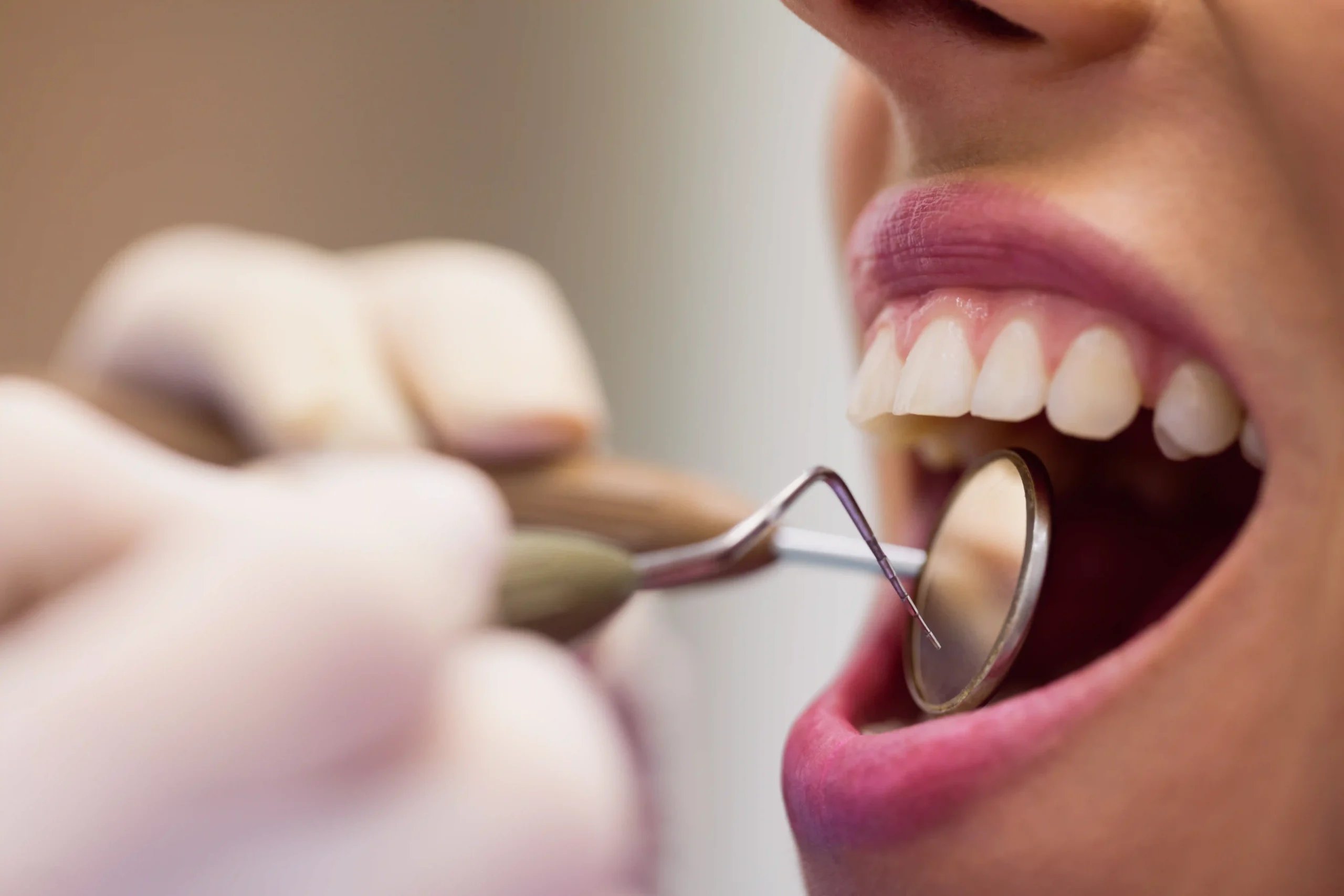 Dental Care in Tijuana, Mexico 11 A professional dentist performing a checkup on a patient, showcasing cosmetic dentistry in Mexico and dental care in Tijuana.