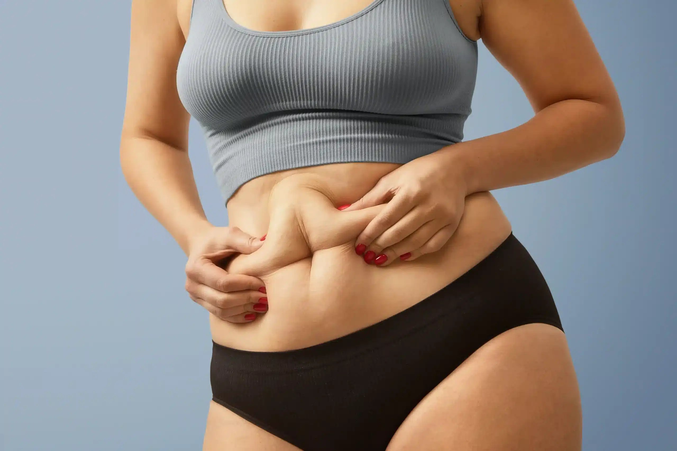 Gastric Bypass in Tijuana, Mexico 11 Woman holding excess tummy fat, considering bariatric surgery in Tijuana for health improvement.