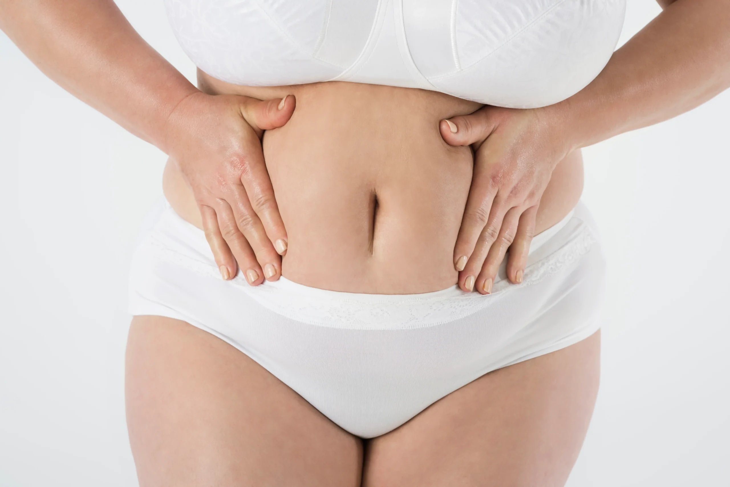 Tummy Tuck in Tijuana, Mexico 13 Close-up of a patient's midsection being evaluated for a tummy tuck in Tijuana or abdominoplasty in Tijuana.