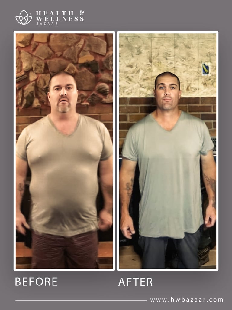 Before & After Gallery 10 Frontal photograph of a man before and after bariatric surgery. The "before" image shows the man overweight. The "after" image shows significant weight loss, with a flatter abdomen and a leaner physique, reflecting the success of the procedure performed at Health & Wellness Bazaar.