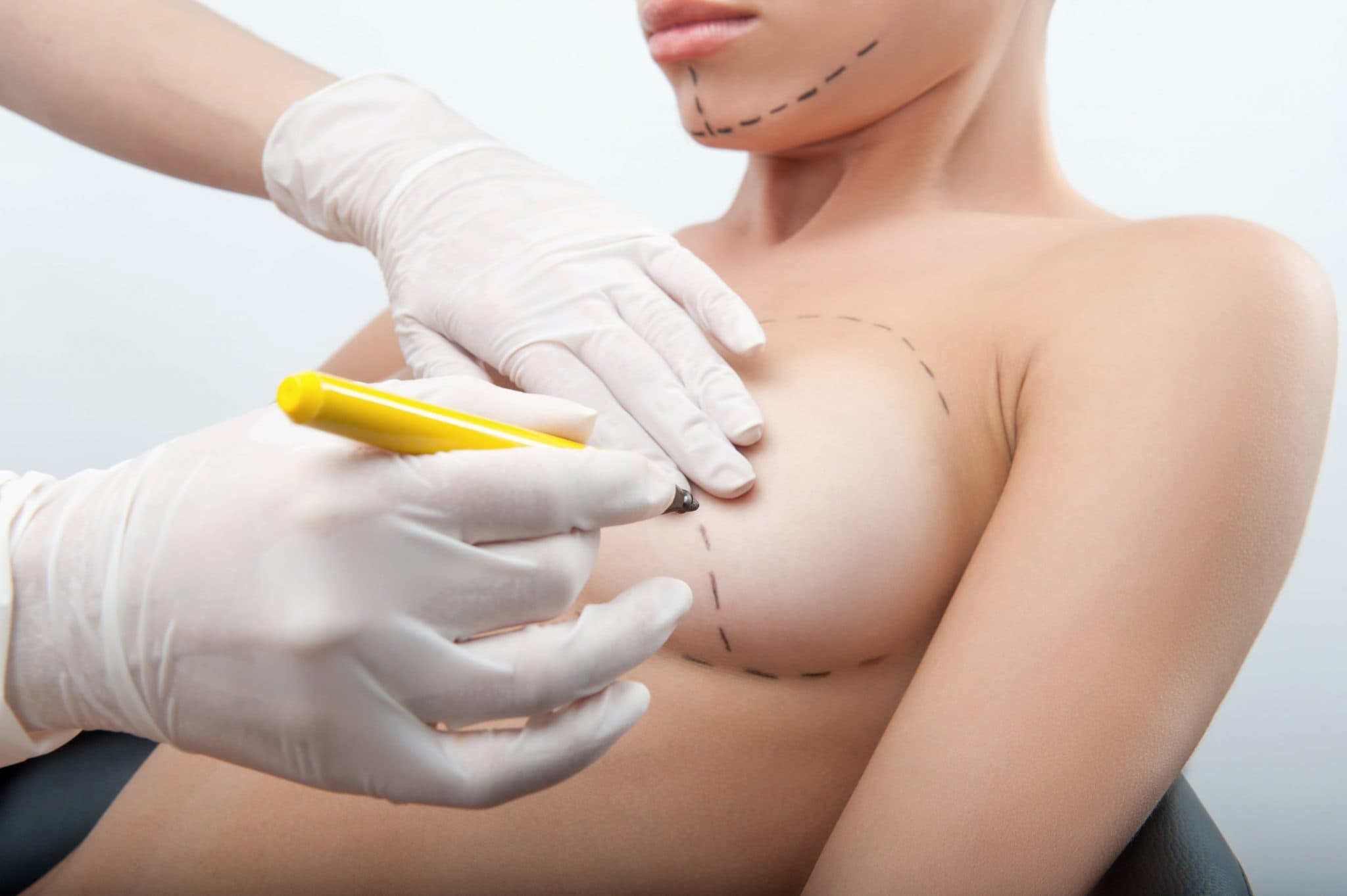 Feel Pretty With Breast Implants