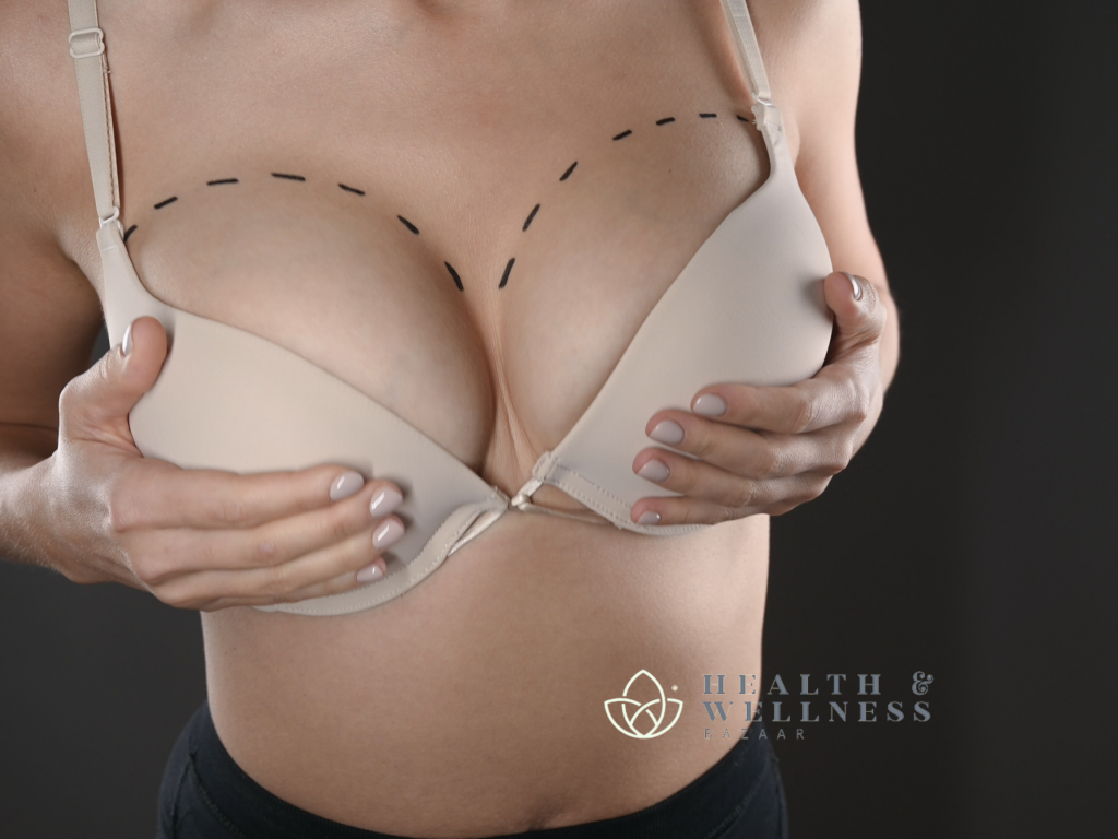 8 Frequently Asked Questions About Breast Augmentation in Tijuana