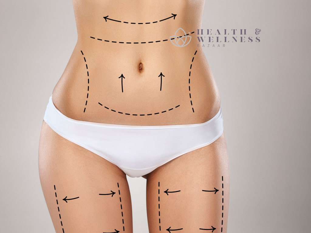 Liposculpture in Mexico: What Is Its Cost?