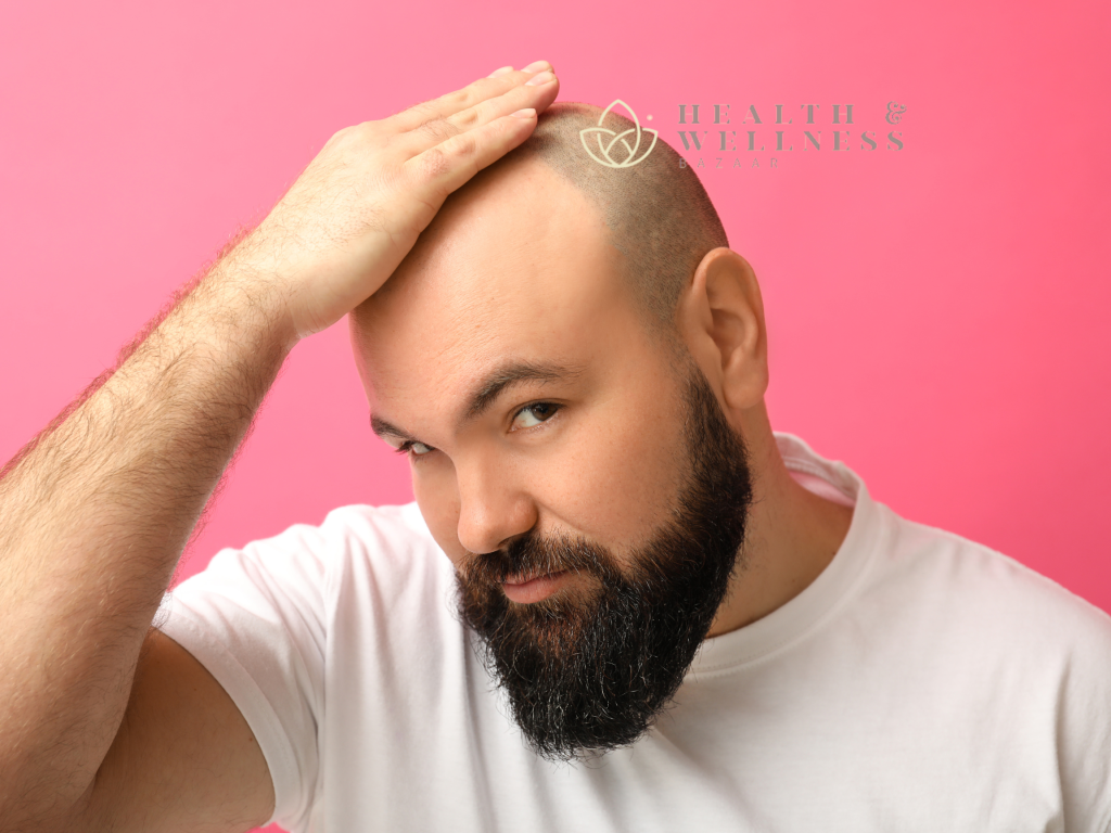 Hair Transplant in Mexico: What Are the Advantages and Disadvantages?