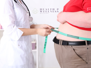 Gastric sleeve in Mexico