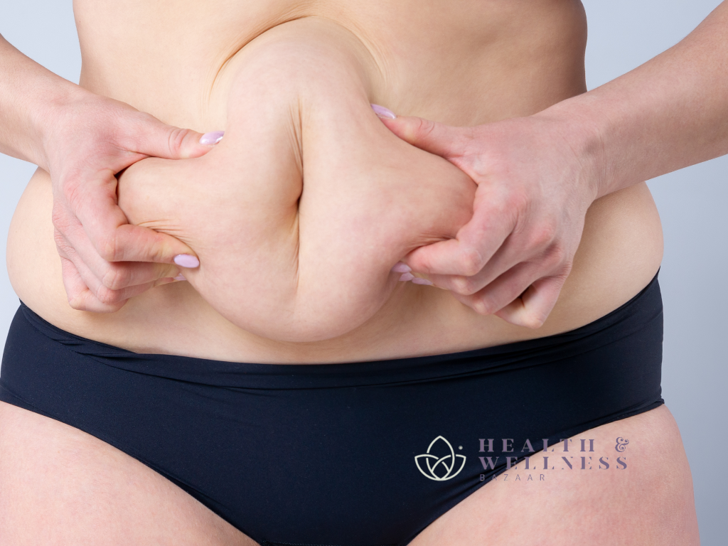 Tummy Tuck in Mexico: Requirements, Preparation, and Recovery