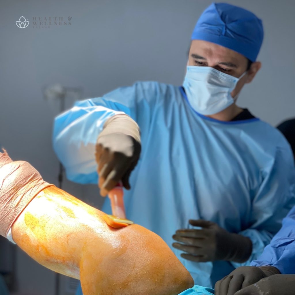 Orthopedic Surgeon in Tijuana: How to Get Ready for Your Consultation