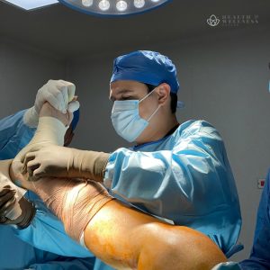 Knee replacement in Mexico