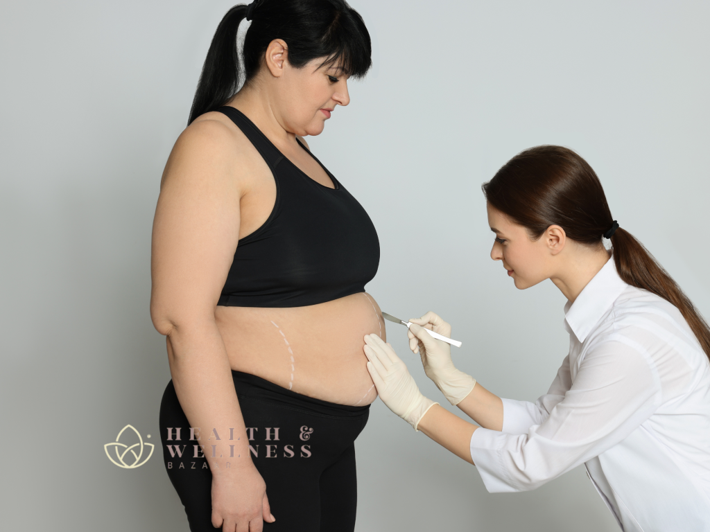 Experience a Fresh Start with Bariatric Surgery in Mexico