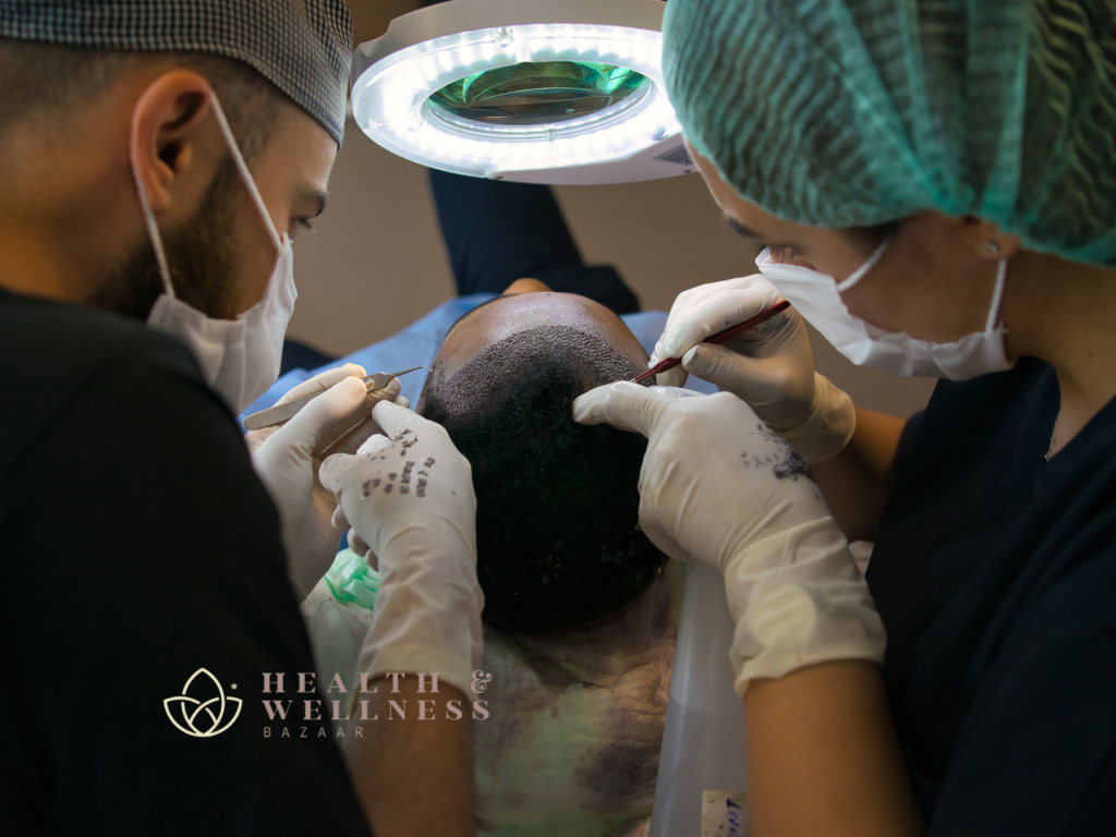 What Is the Cost of a Hair Transplant in Tijuana? Tips for Affordable Results