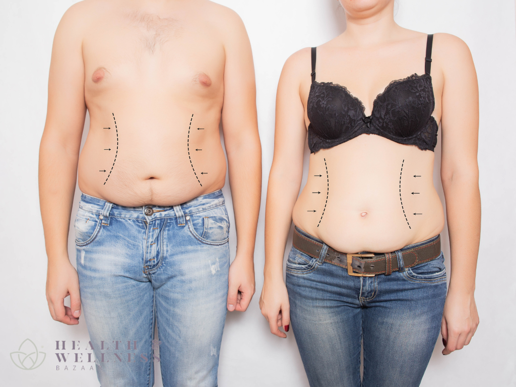 How Much Is a Tummy Tuck in Mexico? An Ultimate Guide for Patients