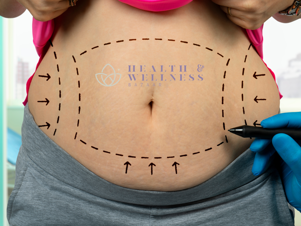 3 Crucial Aspects of How Much is Liposuction in Mexico