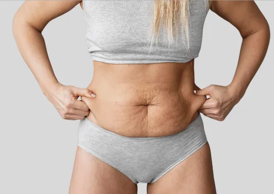 Body Contouring After weight loss