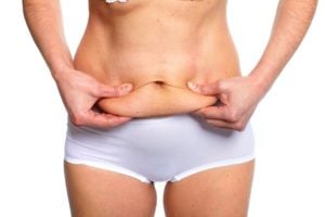 Tummy tuck in Tijuana