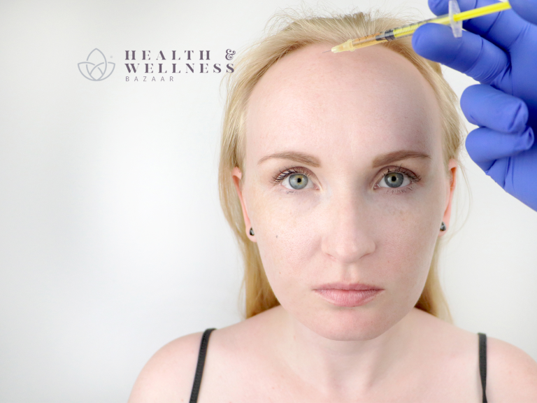 hair transplant in Mexico