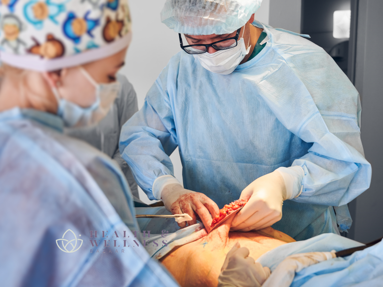 tummy tuck Mexico