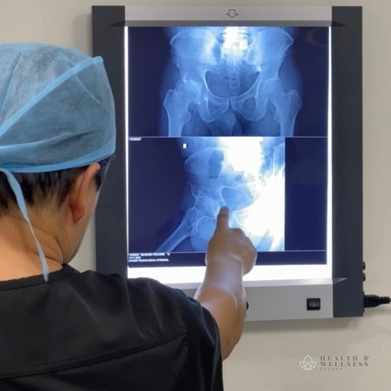 medical tourism Mexico