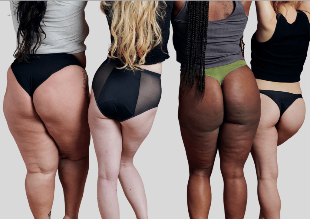 Brazilian Butt Lift (BBL) in Tijuana, Mexico, showing diverse body shapes after surgery.