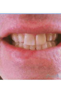 Dental 3B