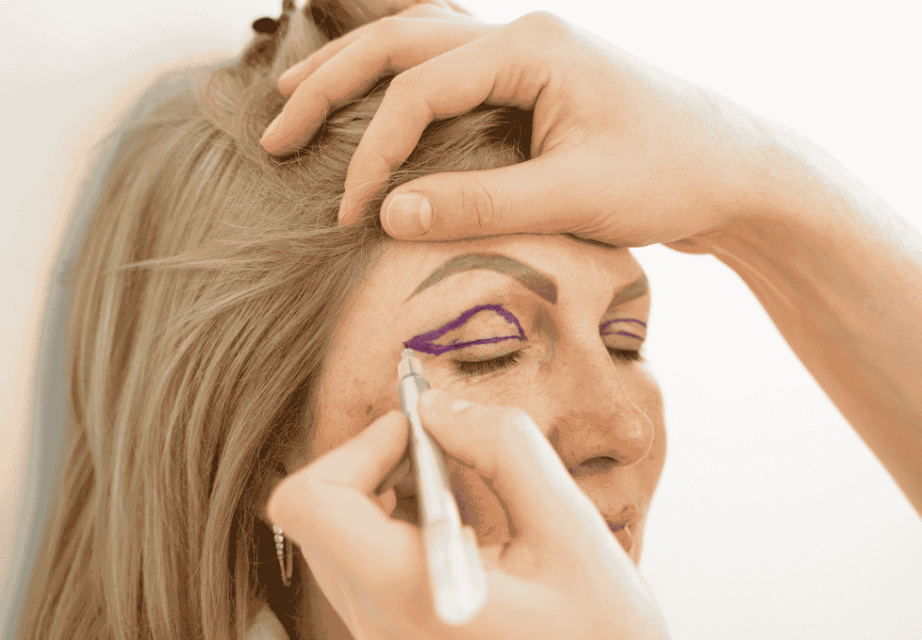 A surgeon marks a patient’s eyelids with a surgical pen in preparation for eyelid surgery (blepharoplasty) to enhance the eye area.