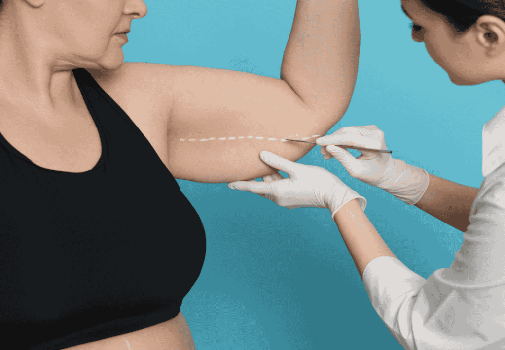 A woman checking for excess skin on her upper arm, considering an arm lift in Tijuana, Mexico.