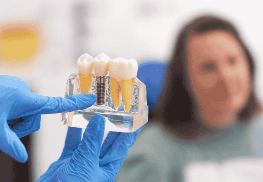 A dental professional wearing blue gloves demonstrates a model of dental implants to a patient, showing tooth replacements with titanium posts.