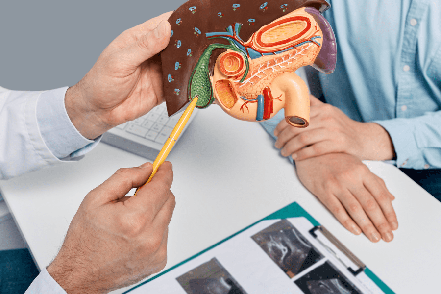 A doctor explaining gallbladder removal surgery using an anatomical model of the digestive system, highlighting the gallbladder and bile ducts. The image represents a medical consultation for cholecystectomy in Tijuana, Mexico.