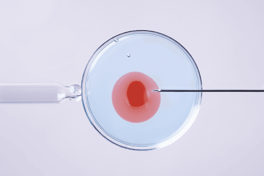 Laboratory close-up of an egg retrieval process using a needle in a petri dish, symbolizing IVF treatment.