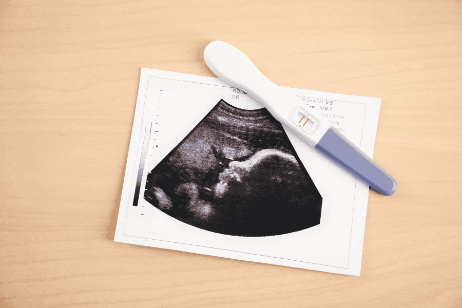 Positive pregnancy test placed on top of an ultrasound image, symbolizing pregnancy confirmation.