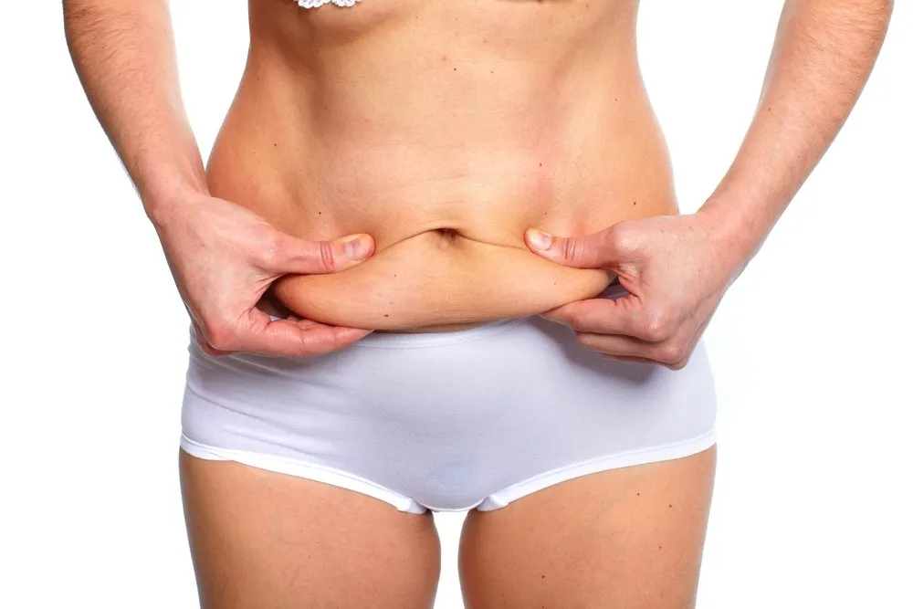 Close-up of excess abdominal skin before a tummy tuck surgery for body contouring.