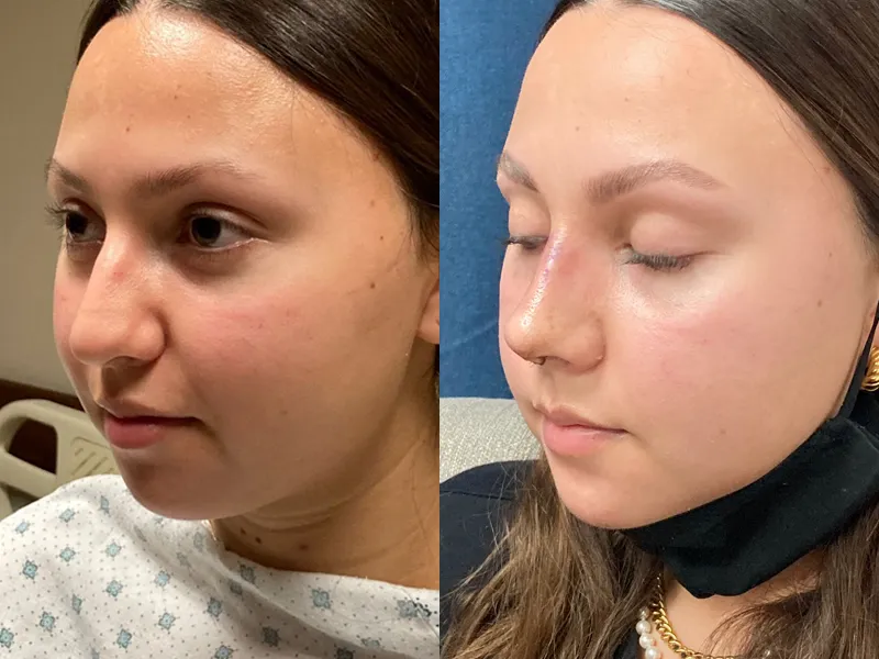 Medical Tourism in Tijuana | Affordable Surgery Packages 18 rhyno