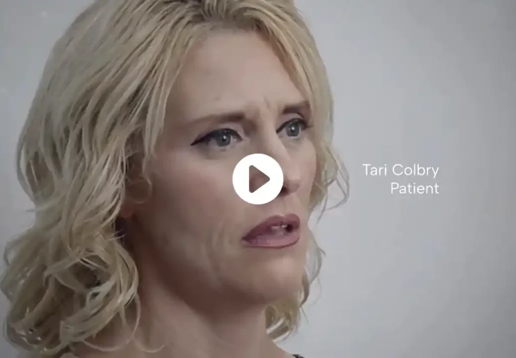 Mommy Makeover in Tijuana, Mexico — Restore Your Confidence 22 Frontal photograph of a woman with her arms raised and extended. Surgical results are visible on her arms (lift scars) and bust, indicating a post-weight loss body contouring or Mommy Makeover.