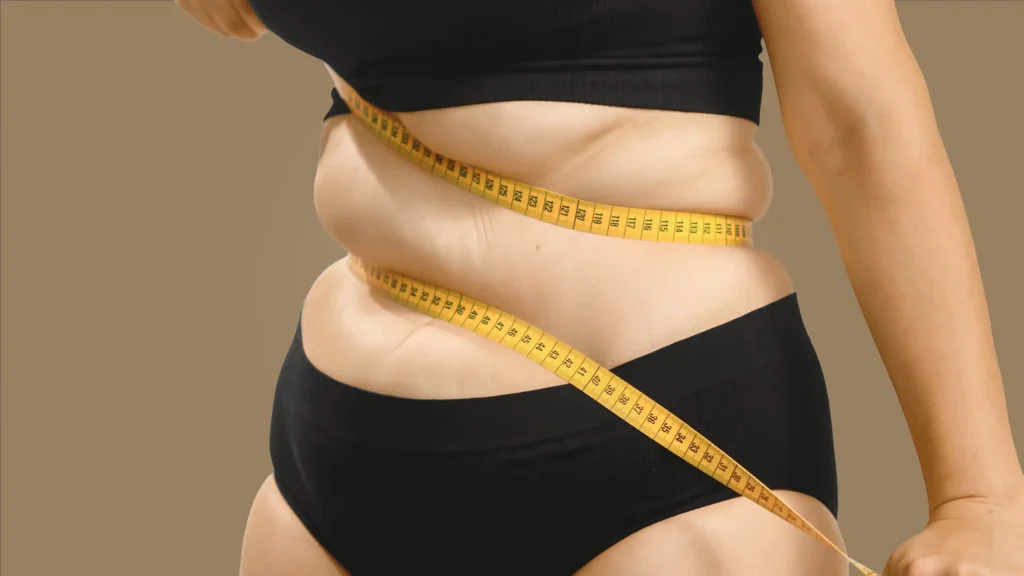 Gastric Sleeve Surgery in Tijuana, Mexico 13 Woman measuring abdominal area with excess weight, illustrating the starting point for gastric sleeve surgery in Tijuana and bariatric surgery.