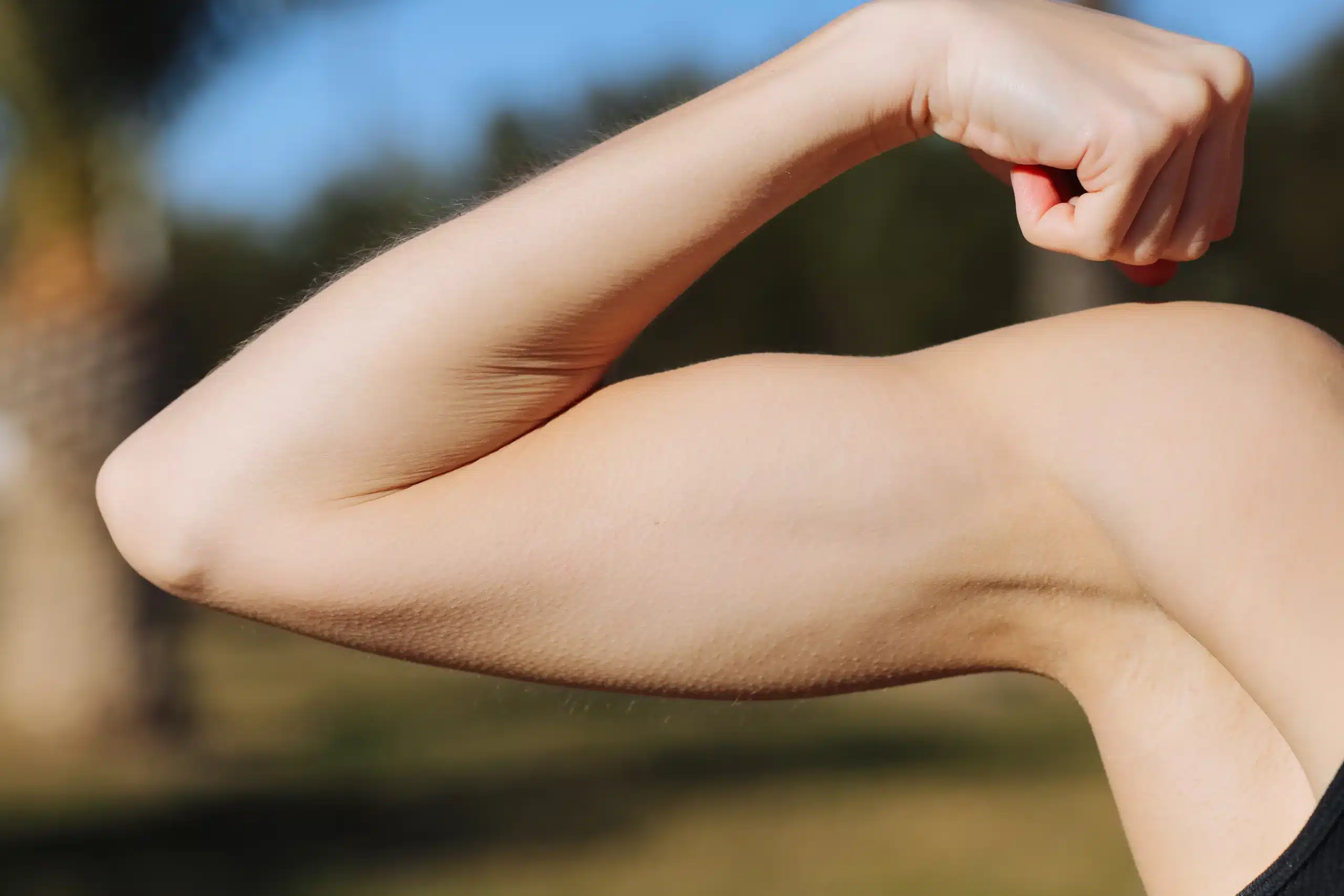 Arm Lift in Tijuana, Mexico 11 Close-up of a woman flexing her toned arm outdoors, showing the firm, tight skin results achievable with an Arm Lift in Tijuana and brachioplasty.