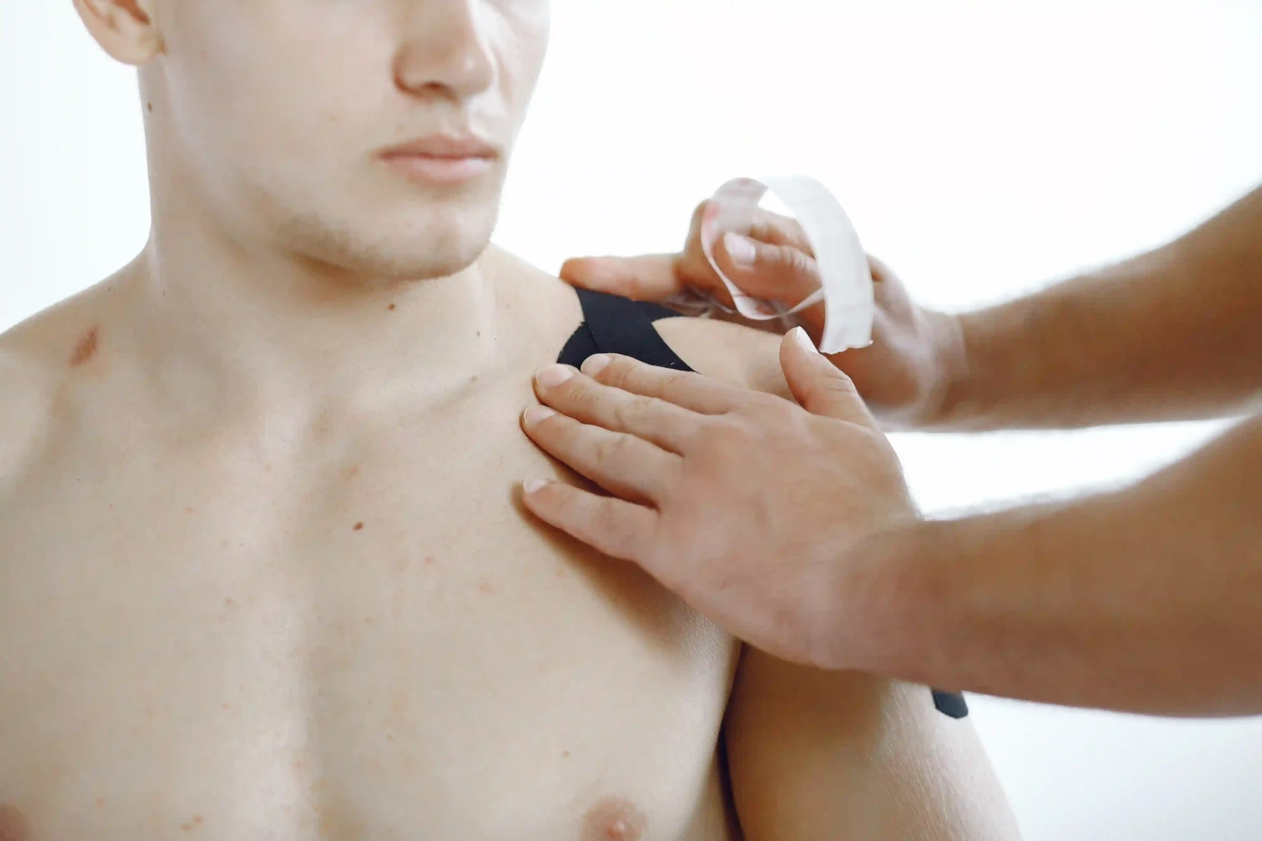 Rotator Cuff Repair in Tijuana, Mexico 11 Patient receiving kinesiotherapy tape treatment after rotator cuff repair surgery in Mexico.