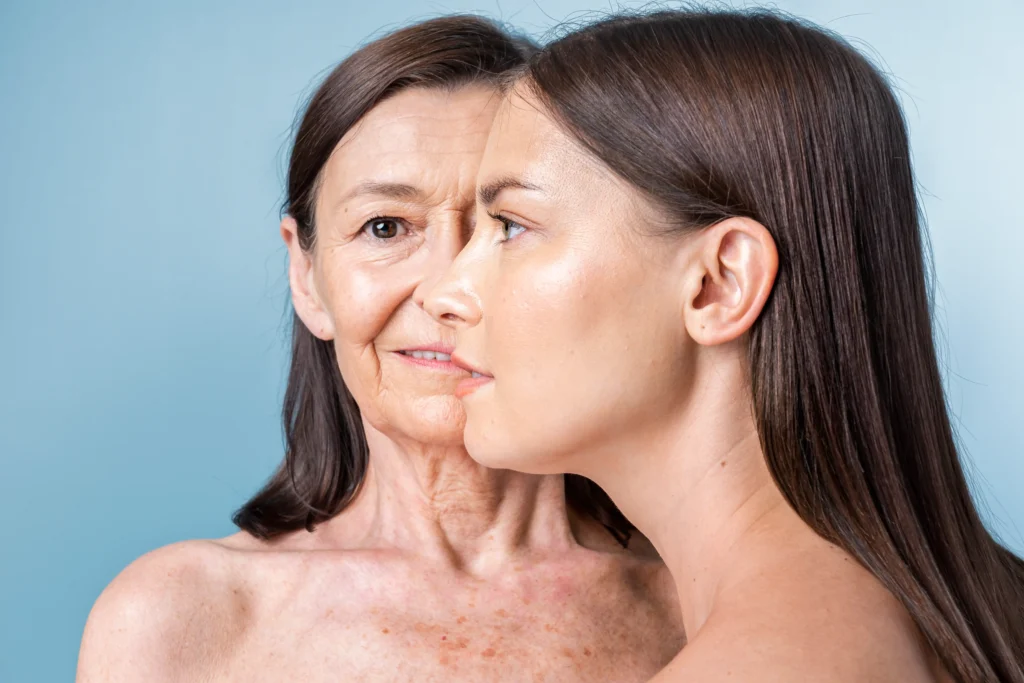 Facelift in Tijuana, Mexico 14 A side-by-side comparison of a mature woman with visible wrinkles and a younger woman, illustrating the targets of facial rejuvenation surgery in Tijuana.